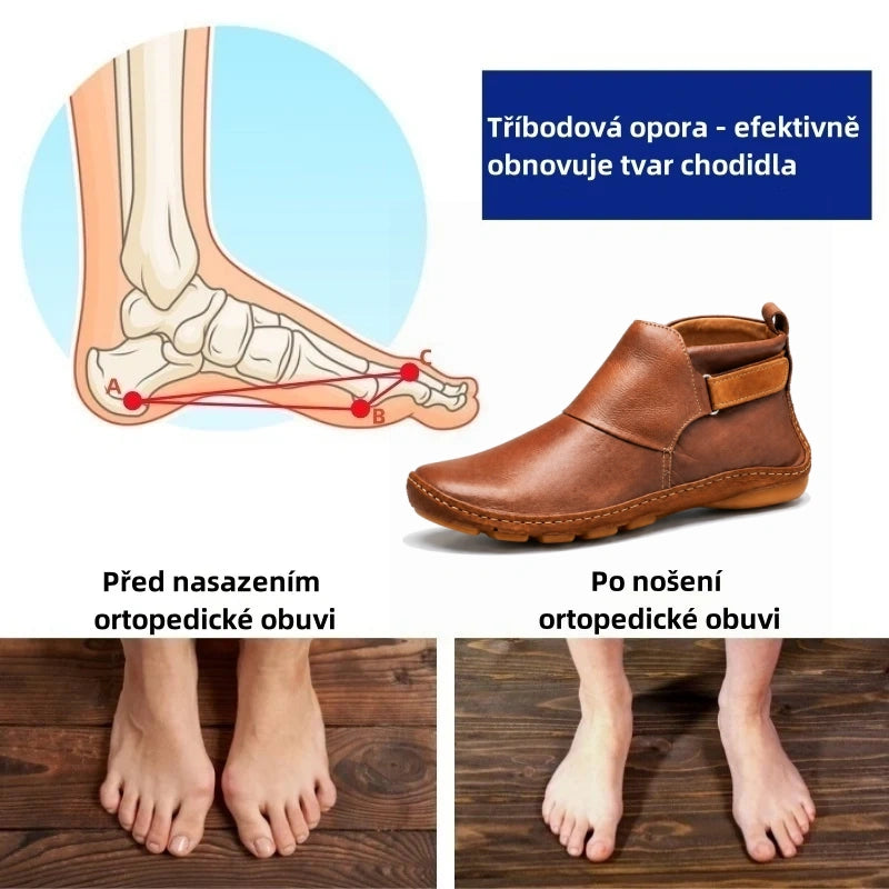 🔥 Obuwie ortopedyczne dla kobiet o ergonomicznej konstrukcji, skutecznie łagodzące bóle stóp, kolan i pleców