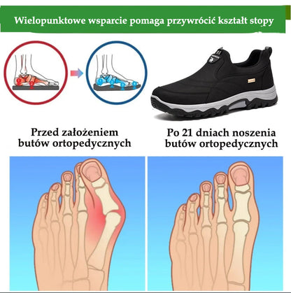 🔥 50% zniżki | buty ortopedyczne flemat® | Zapewniają wsparcie łuku stopy, łagodzą ból i ułatwiają chodzenie