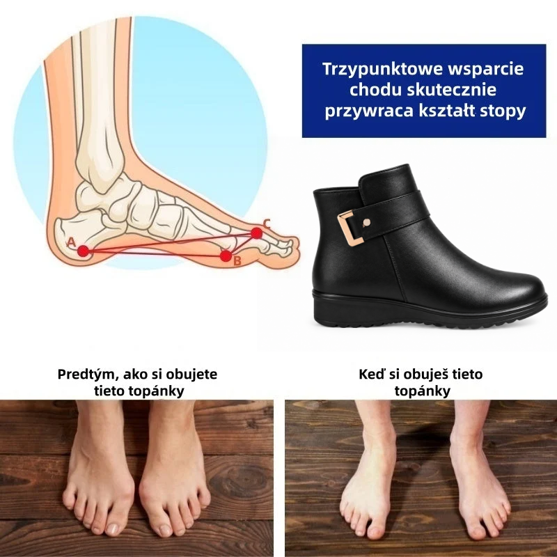 (🎉 Dzisiejsza oferta specjalna – nie przegap!) ⏰ Ergonomicznie zaprojektowane ortopedyczne buty zimowe, które skutecznie łagodzą ból stóp, kolan i pleców.